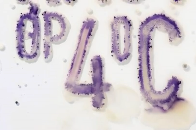 Lemz Agency and Netherlands Nutrition Centre, Food Poisoning Campaign